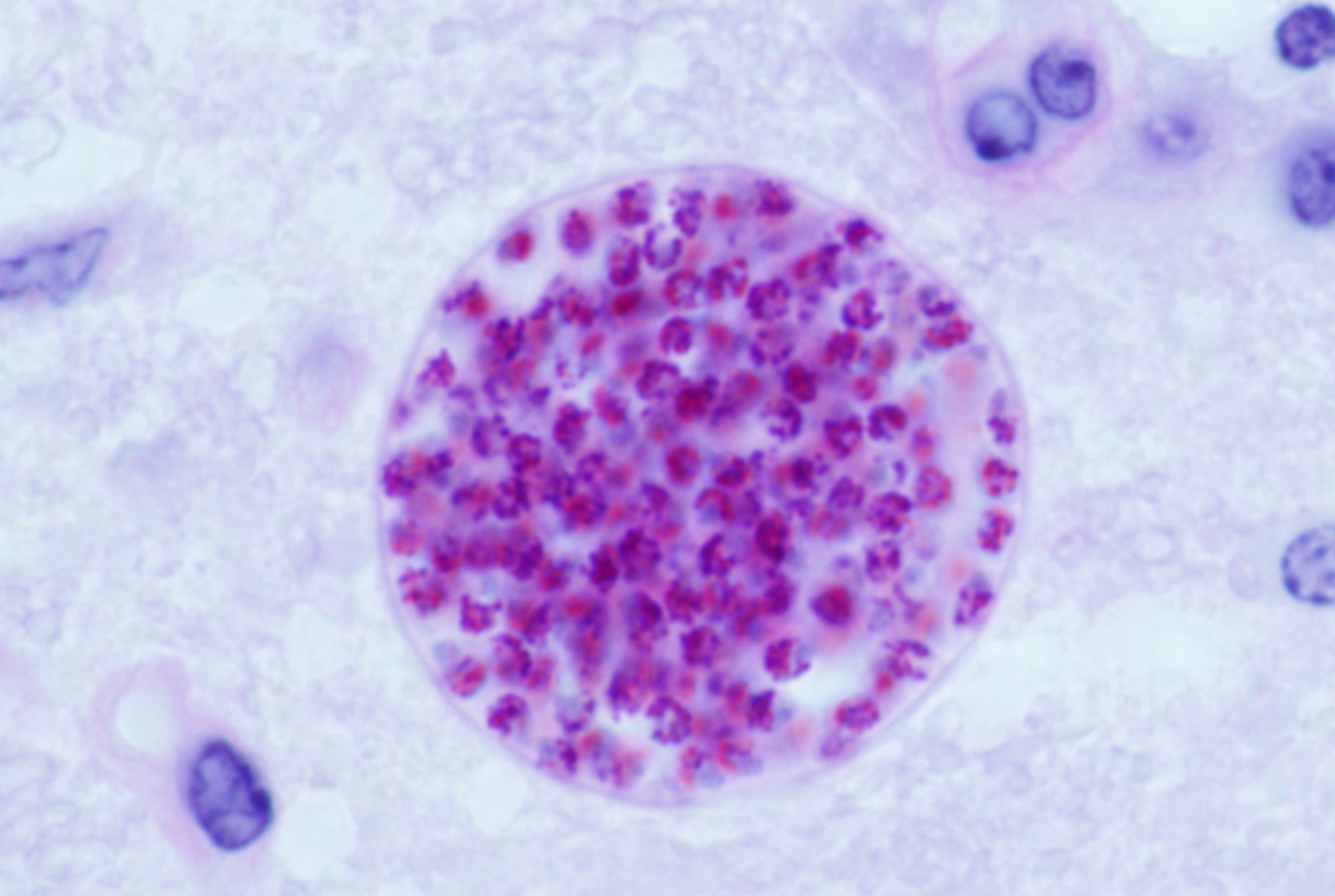 toxoplasma